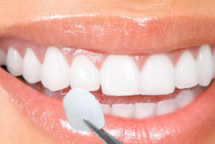  Clínica dentária também é lugar de cuidar da beleza