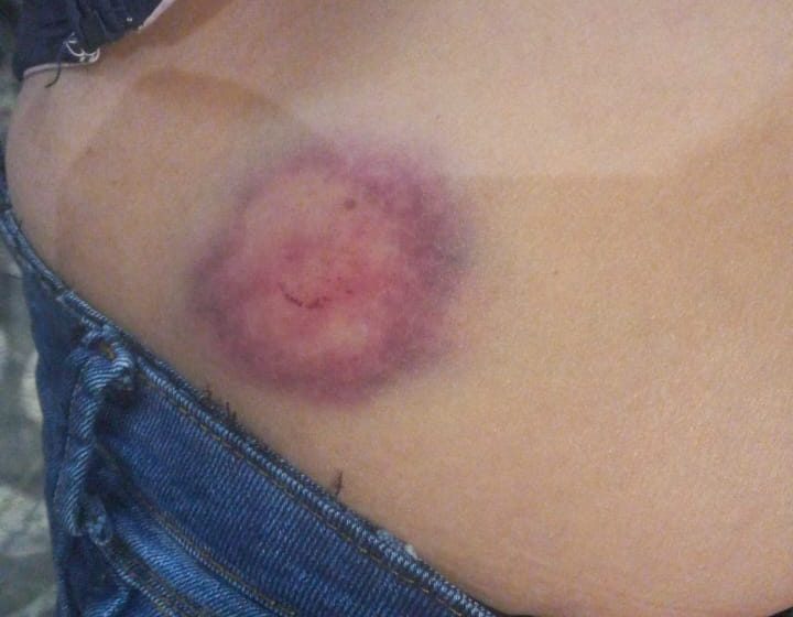  GCM de Cotia prende homem que efetuou disparos e feriu uma mulher  