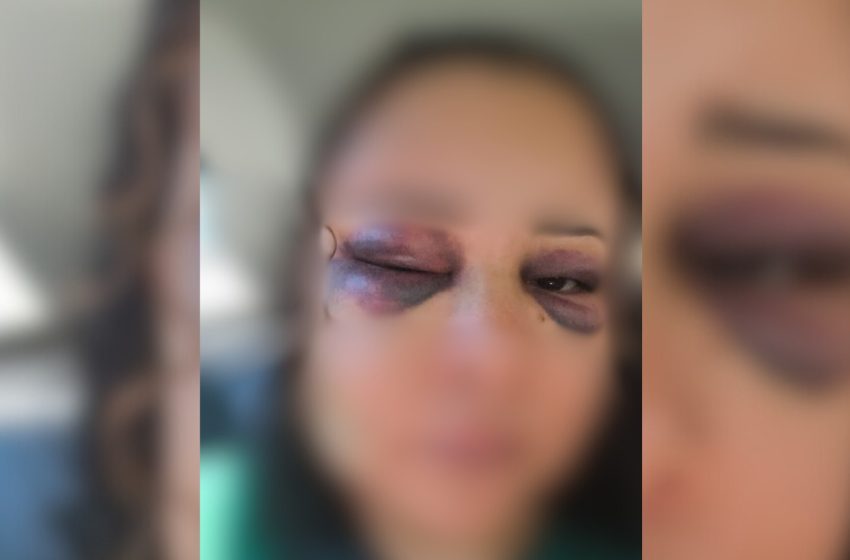  Mulher sofre fraturas após agressão em apartamento em são josé do rio preto