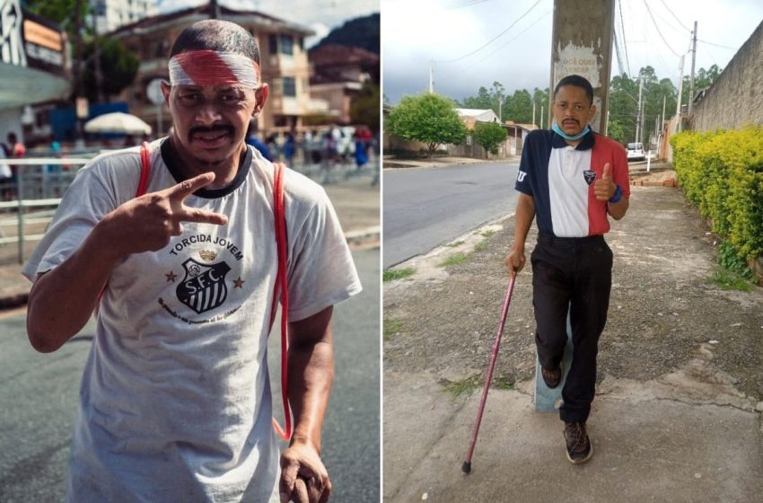  Torcedor do Santos morto por veículo da PM vivia nas ruas e era PCD