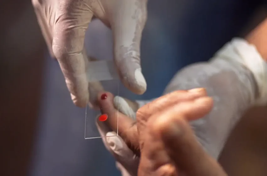  SUS inicia novo tratamento contra a malária para crianças menores de 16