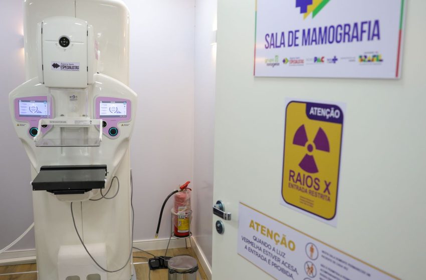  Cirurgias de Mama no SUS: Crescimento de 54% em Uma Década e o Foco na Necessidade Médica