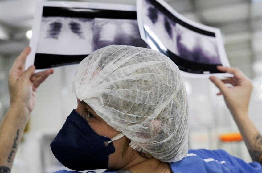  Câncer de Pulmão: Diagnóstico Tardio no SUS Alerta para Falhas na Prevenção e Rastreamento